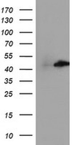 CENPH Monoclonal Antibody (OTI1D5), TrueMAB , OriGene 100 &mu;L; Unconjugated:Antibodies,