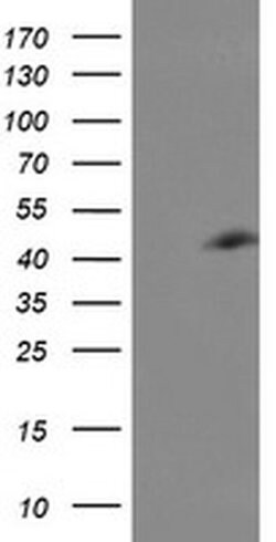 CENPH Monoclonal Antibody (OTI1A6), TrueMAB , OriGene 100 &mu;L; Unconjugated:Antibodies,
