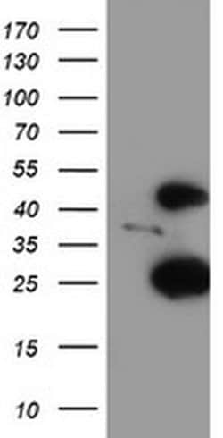 CENPH Monoclonal Antibody (OTI2A11), TrueMAB , OriGene 30 &mu;L; Unconjugated:Antibodies,