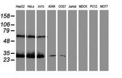CENPH Monoclonal Antibody (OTI2A11), TrueMAB , OriGene 30 &mu;L; Unconjugated:Antibodies,