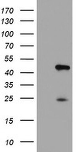 CENPH Monoclonal Antibody (OTI1C2), TrueMAB , OriGene 30 &mu;L; Unconjugated:Antibodies,