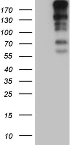 CENPJ Monoclonal Antibody (OTI3G8), TrueMAB , OriGene:Antibodies:Primary