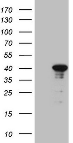 CENPQ Mouse anti-Human, Clone: OTI1C5, lyophilized, TrueMAB 100 &mu;g;