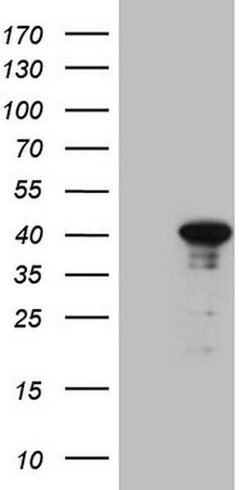 CENPQ Monoclonal Antibody (OTI1C5), TrueMAB , OriGene:Antibodies:Primary