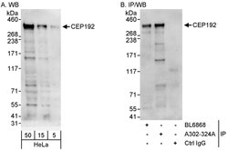 CEP192 Rabbit anti-Human, Polyclonal, Bethyl Laboratories 100 &mu;l; Unlabeled:Antibodies,
