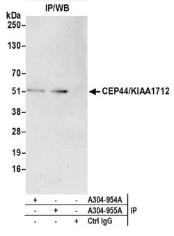 CEP44/KIAA1712 Rabbit anti-Human, Polyclonal, Bethyl Laboratories 10 &mu;L;