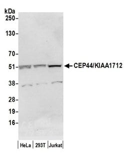 CEP44/KIAA1712 Rabbit anti-Human, Polyclonal, Bethyl Laboratories 10 &mu;L;