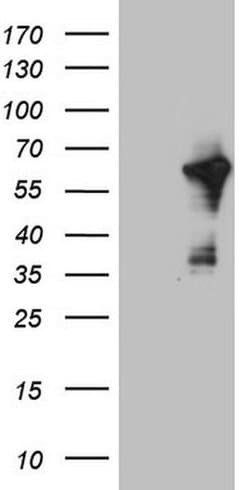CEP55 Monoclonal Antibody (OTI6H3), TrueMAB , OriGene 100 &mu;L; Unconjugated:Antibodies,