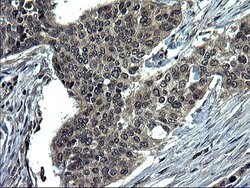 CEP68 Monoclonal Antibody (OTI5D8), TrueMAB , OriGene 100 &mu;L; Unconjugated:Antibodies,