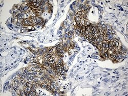 CEP72 Mouse anti-Human, Clone: OTI4D2, lyophilized, TrueMAB 100 &mu;g;