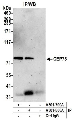 CEP78 Rabbit anti-Human, Polyclonal, Bethyl Laboratories 100 &mu;L; Unconjugated:Antibodies,
