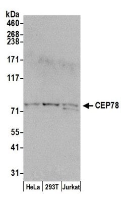 CEP78 Polyclonal Antibody, Bethyl Laboratories 20 &mu;l; Unlabeled:Antibodies,