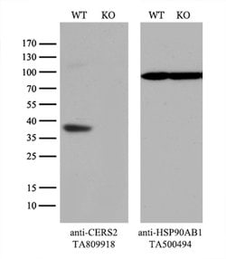 CERS2 Mouse anti-Human, Clone: OTI3D9, lyophilized, TrueMAB 100 &mu;g;