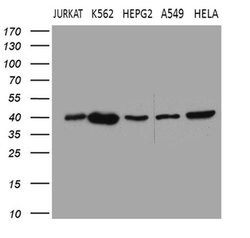 CERS2 Monoclonal Antibody (OTI3D9), TrueMAB , OriGene 100 &mu;L; Unconjugated:Antibodies,