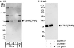 CERT/GPBP Rabbit anti-Human, Polyclonal, Bethyl Laboratories 100 &mu;L;