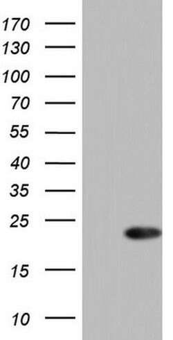 CETN1 Monoclonal Antibody (OTI1B12), TrueMAB , OriGene 100 &mu;L; Unconjugated:Antibodies,