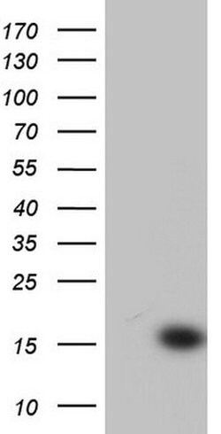 CETN1 Monoclonal Antibody (OTI7G7), TrueMAB , OriGene 100 &mu;L; Unconjugated:Antibodies,