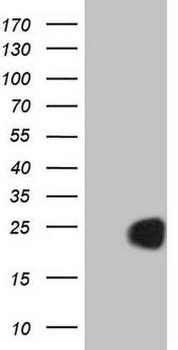 CETN3 Monoclonal Antibody (OTI4G5), TrueMAB , OriGene 100 &mu;L; Unconjugated:Antibodies,