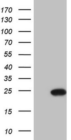 CETN3 Monoclonal Antibody (OTI2C2), TrueMAB , OriGene:Antibodies:Primary