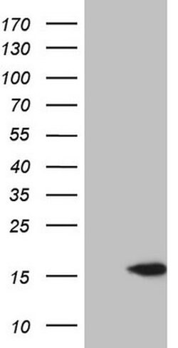 CETN3 Mouse anti-Human, Clone: OTI3B5, lyophilized, TrueMAB 100 &mu;g;