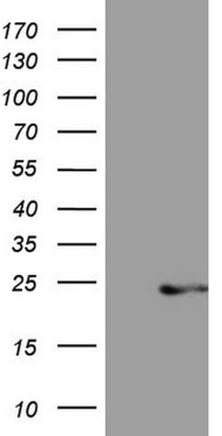 CETN3 Mouse anti-Human, Clone: OTI1D6, lyophilized, TrueMAB 100 &mu;g;