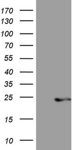 CETN3 Monoclonal Antibody (OTI1D6), TrueMAB , OriGene 100 &mu;L; Unconjugated:Antibodies,