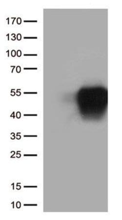 SLAMF7 Mouse anti-Human, Clone: OTI5H5, TrueMAB , Origene 100 &mu;g | Buy Online | Origene Technologies | Fisher Scientific