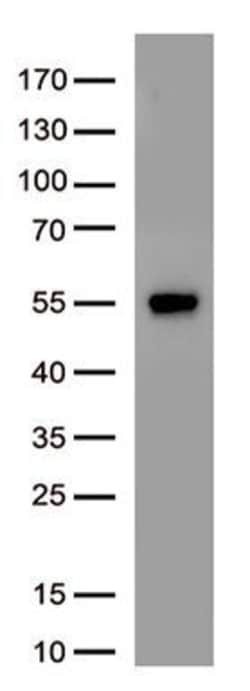 SARS-CoV-2 N Protein Mouse anti-Virus, Clone: OTI8G10, TrueMAB , Origene