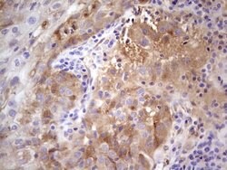 CFI Mouse anti-Human, Clone: OTI15H9, lyophilized, TrueMAB 100 &mu;g; Unconjugated:Antibodies,
