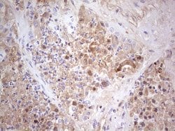 CFI Monoclonal Antibody (OTI17F1), TrueMAB , OriGene:Antibodies:Primary