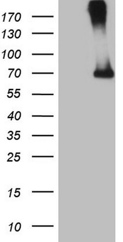 CFI Monoclonal Antibody (OTI4G8), TrueMAB , OriGene 100 &mu;L | Buy Online | Origene Technologies | Fisher Scientific