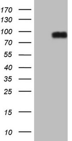 CFI Mouse anti-Human, Clone: OTI7C4, lyophilized, TrueMAB 100 &mu;g; Unconjugated:Antibodies,