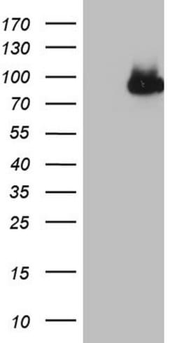 CFI Monoclonal Antibody (OTI17F1), TrueMAB , OriGene:Antibodies:Primary