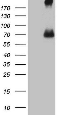 CFI Monoclonal Antibody (OTI4A8), TrueMAB , OriGene 100 &mu;L; Unconjugated:Antibodies,