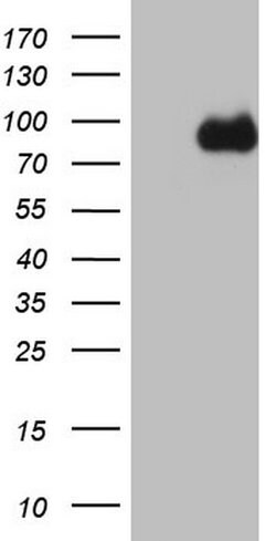 CFI Mouse anti-Human, Clone: OTI17E6, lyophilized, TrueMAB 100 &mu;g; Unconjugated:Antibodies,
