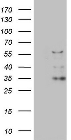 CFLAR Monoclonal Antibody (OTI2H3), TrueMAB , OriGene 100 &mu;L; Unconjugated:Antibodies,