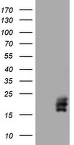 CGB Monoclonal Antibody (OTI2A3), TrueMAB , OriGene:Antibodies:Primary