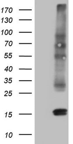 CGB Monoclonal Antibody (OTI12H5), TrueMAB , OriGene 100 &mu;L; Unconjugated:Antibodies,