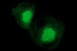 CHAC1 Mouse anti-Human, Clone: OTI4A11, lyophilized, TrueMAB 100 &mu;g;