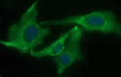 CHAC1 Mouse anti-Human, Clone: OTI4A11, lyophilized, TrueMAB 100 &mu;g;