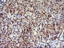 CHAC1 Mouse anti-Human, Clone: OTI1E2, liquid, TrueMAB 100 &mu;L; Unconjugated:Antibodies,