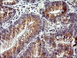CHAC1 Mouse anti-Human, Clone: OTI1E2, liquid, TrueMAB 100 &mu;L; Unconjugated:Antibodies,