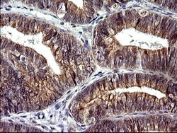 CHAC1 Mouse anti-Human, Clone: OTI1E2, liquid, TrueMAB 100 &mu;L; Unconjugated:Antibodies,