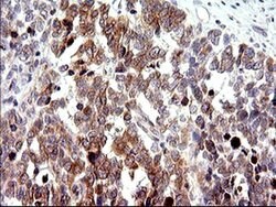 CHAC1 Mouse anti-Human, Clone: OTI1E2, liquid, TrueMAB 100 &mu;L; Unconjugated:Antibodies,
