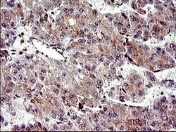 CHAC1 Mouse anti-Human, Clone: OTI1E2, liquid, TrueMAB 100 &mu;L; Unconjugated:Antibodies,
