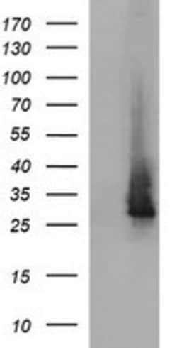 CHAC1 Mouse anti-Human, Clone: OTI1E3, lyophilized, TrueMAB 100 &mu;g;
