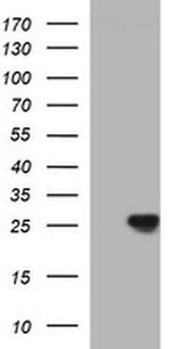 CHAC1 Monoclonal Antibody (OTI4B3), TrueMAB , OriGene:Antibodies:Primary