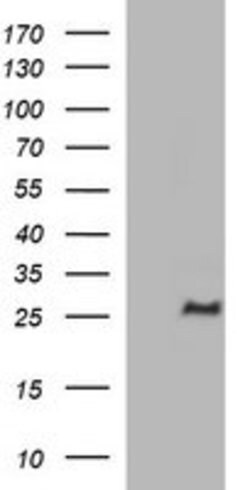 CHAC1 Mouse anti-Human, Clone: OTI4A11, lyophilized, TrueMAB 100 &mu;g;