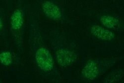 CHAF1B Mouse anti-Human, Clone: OTI2D5, liquid, TrueMAB 100 &mu;L; Unconjugated:Antibodies,