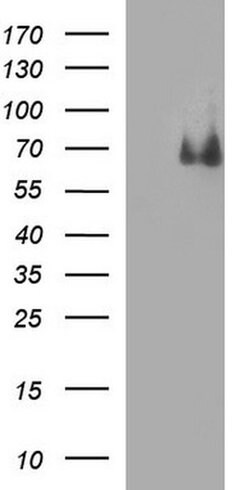 CHAF1B Mouse anti-Human, Clone: OTI2D5, liquid, TrueMAB 100 &mu;L; Unconjugated:Antibodies,
